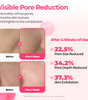 Cemenrete Cyano Pink Spicule Serum